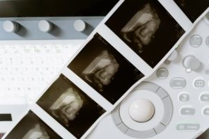 Most abortion used for birth control