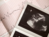 Abortions at home “mean lives of the unborn are devalued,” say evangelicals
