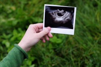UK court to review Down Syndrome abortion law