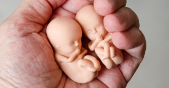 Record-high number of abortions in England and Wales in 2021