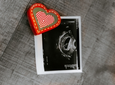 Abortion stops a beating heart &quot;even early in pregnancy&quot; - SFLA takes the truth to U.S. campuses