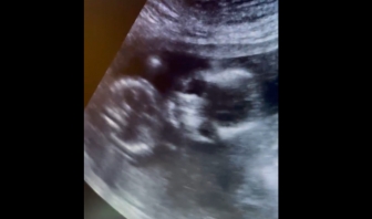 Houston Pregnancy Help Center provided ultrasounds to migrant girls housed at a facility there
