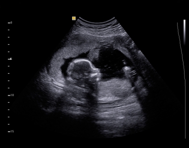 At Pro-Life Centers, the &quot;Come and See&quot; Strategy is Saving Lives