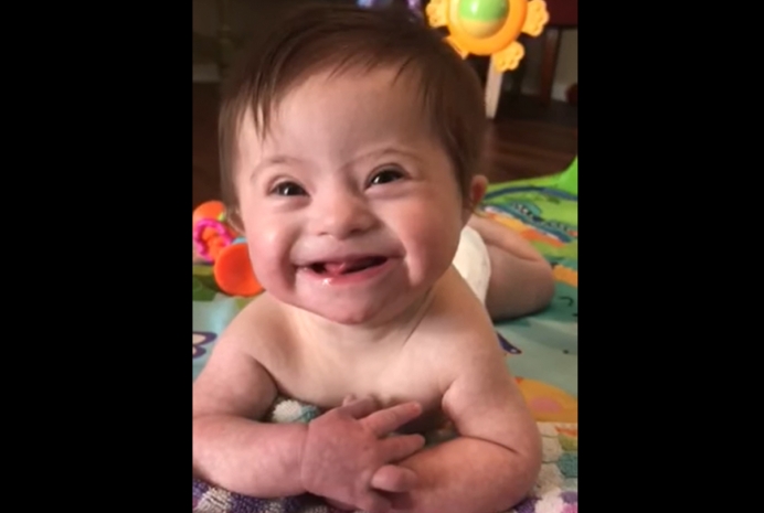 National Down Syndrome Adoption Network Facebook 