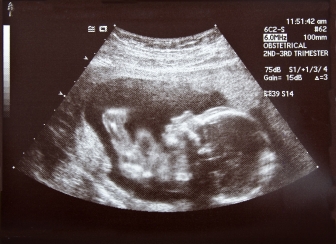 Are civil rights and reproductive rights comparable?