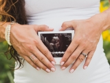 Supreme Court rejects ACLU challenge to Kentucky ultrasound law