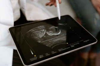 Someone cares: Child killed in on-air NPR abortion segment mourned